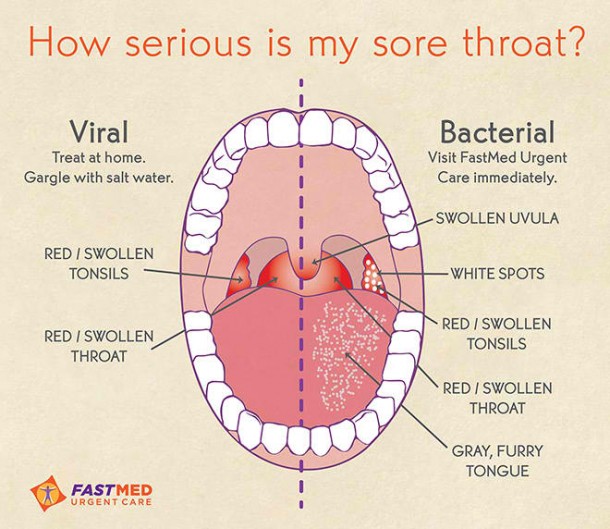 Sore Throat Without Cold Xxx Porn Library