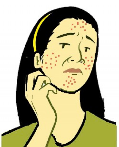 Bakit Nangangati ang Mukha Muka ko? Pantal Namumula Tuyo ang Balat Namamantal Dry Makati Skin Allergy